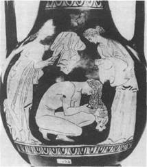 Hygienische Bedeutung des Wassers. Beispiel griechischer Vasenmalerei 6. - 4. Jh. Pelike aus Athen, Nationalmuseum